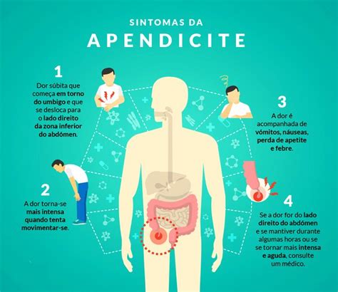 onde fica apendicite-4